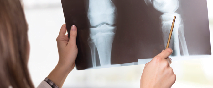 _blog_mainimage_template1